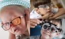 Çocuklarda Gözlük Kullanımının Önemi