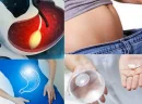 Gastrik Sleeve Ameliyatı Nasıl Yapılır?