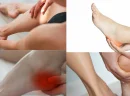 Halluks Rigidus Nedir?