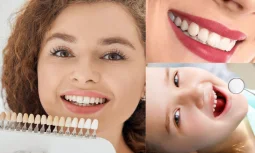 Dentist in İstanbul ile Sağlıklı Gülüşler Neden Tercih Ediliyor?