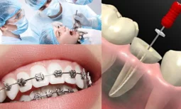 Düzce Diş Teli Fiyatları Nasıl Belirlenir?