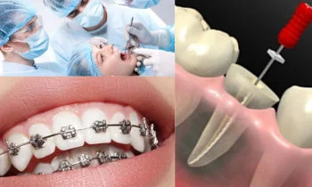 Düzce Diş Teli Fiyatları Nasıl Belirlenir?