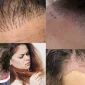 Pousser Les Cheuveux-Saç Büyütmek